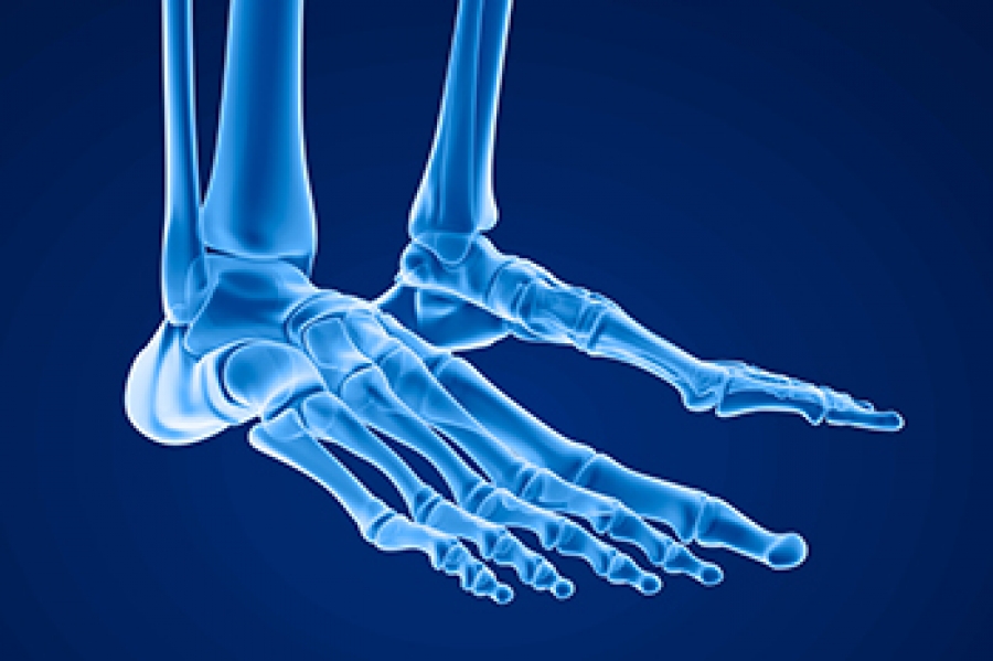 various-types-of-stress-fractures